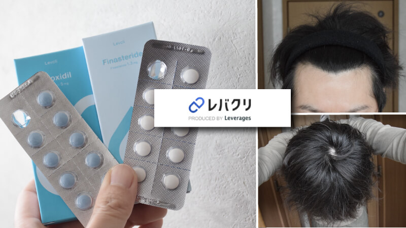 【AGAクリニック体験談】レバクリが1番おすすめ?オンライン診療の感想や口コミ・評判をチェック!